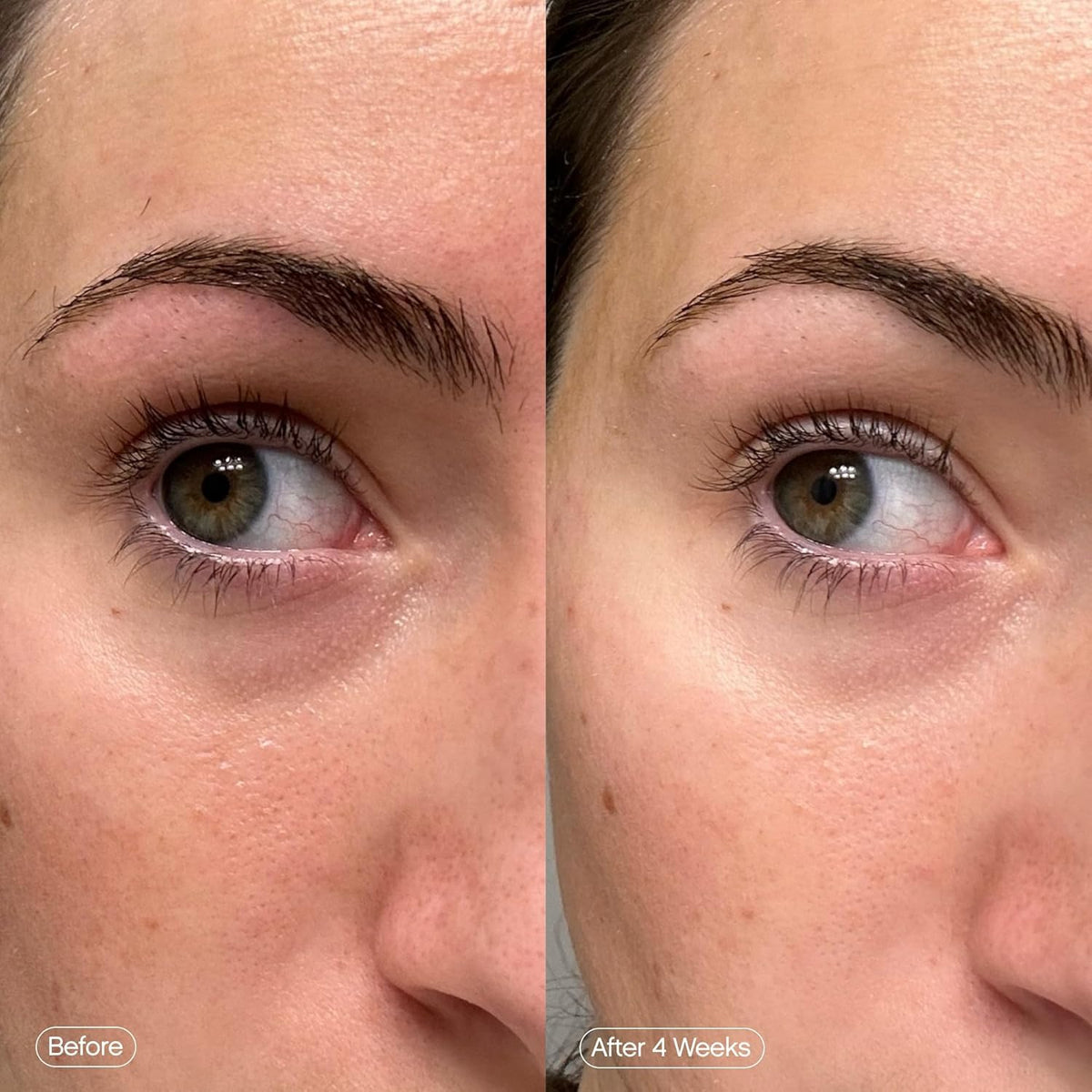 Topicals Faded Brightening Under Eye Masks | Patches to Depuff, Hydrate, Brighten and Cool | Reduce Dark Circles and Fine Lines | Contains Kojic Acid, Caffeine and Niacinamide (2 Sets of 6, 2 Pack)